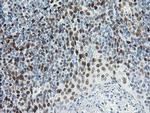 TLE1 Antibody in Immunohistochemistry (Paraffin) (IHC (P))