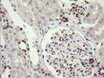 TLE1 Antibody in Immunohistochemistry (Paraffin) (IHC (P))