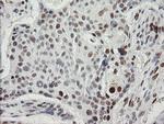 TLE1 Antibody in Immunohistochemistry (Paraffin) (IHC (P))