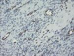 TLE1 Antibody in Immunohistochemistry (Paraffin) (IHC (P))