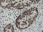 TLE1 Antibody in Immunohistochemistry (Paraffin) (IHC (P))