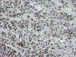 TLE1 Antibody in Immunohistochemistry (Paraffin) (IHC (P))