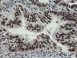 TLE1 Antibody in Immunohistochemistry (Paraffin) (IHC (P))