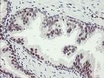 TLE1 Antibody in Immunohistochemistry (Paraffin) (IHC (P))