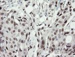 TLE1 Antibody in Immunohistochemistry (Paraffin) (IHC (P))