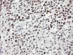 TLE1 Antibody in Immunohistochemistry (Paraffin) (IHC (P))