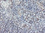 TLE1 Antibody in Immunohistochemistry (Paraffin) (IHC (P))