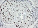 TLE1 Antibody in Immunohistochemistry (Paraffin) (IHC (P))