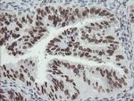 TLE1 Antibody in Immunohistochemistry (Paraffin) (IHC (P))