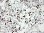 TLE1 Antibody in Immunohistochemistry (Paraffin) (IHC (P))