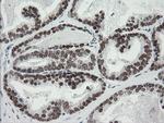 TLE1 Antibody in Immunohistochemistry (Paraffin) (IHC (P))