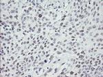 TLE1 Antibody in Immunohistochemistry (Paraffin) (IHC (P))