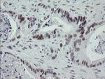 TLE1 Antibody in Immunohistochemistry (Paraffin) (IHC (P))