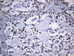 TLE1 Antibody in Immunohistochemistry (Paraffin) (IHC (P))