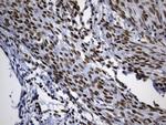 TLE1 Antibody in Immunohistochemistry (Paraffin) (IHC (P))