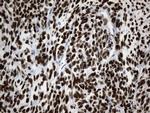 TLE1 Antibody in Immunohistochemistry (Paraffin) (IHC (P))