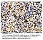 TLR3 Antibody in Immunohistochemistry (IHC)