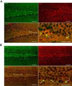 TLR4 Antibody in Immunohistochemistry (Paraffin) (IHC (P))