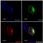 CD284 (TLR4) Antibody in Immunocytochemistry (ICC/IF)