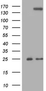 TLR8 Antibody in Western Blot (WB)