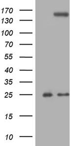 TLR8 Antibody in Western Blot (WB)