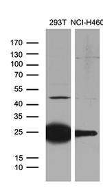 TLR8 Antibody in Western Blot (WB)