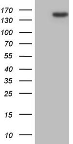 TLR8 Antibody in Western Blot (WB)