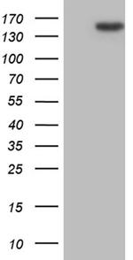 TLR8 Antibody in Western Blot (WB)