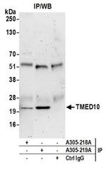 TMED10/TMP21 Antibody in Western Blot (WB)