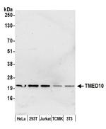 TMED10/TMP21 Antibody in Western Blot (WB)