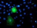 TMEFF2 Antibody in Immunocytochemistry (ICC/IF)