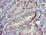 TMEFF2 Antibody in Immunohistochemistry (Paraffin) (IHC (P))