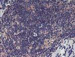 TMEFF2 Antibody in Immunohistochemistry (Paraffin) (IHC (P))