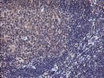 TMEFF2 Antibody in Immunohistochemistry (Paraffin) (IHC (P))