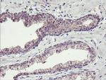 TMEFF2 Antibody in Immunohistochemistry (Paraffin) (IHC (P))