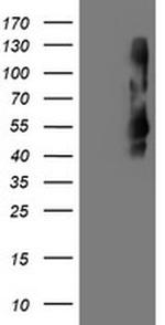 TMEFF2 Antibody in Western Blot (WB)