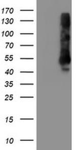 TMEFF2 Antibody in Western Blot (WB)