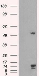 TMEM100 Antibody in Western Blot (WB)