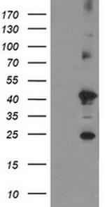 TMEM173 Antibody in Western Blot (WB)