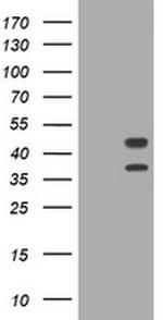 TMEM173 Antibody in Western Blot (WB)