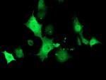 TMOD1 Antibody in Immunocytochemistry (ICC/IF)