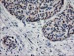 TMOD1 Antibody in Immunohistochemistry (Paraffin) (IHC (P))