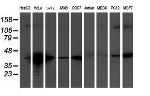 TMOD1 Antibody in Western Blot (WB)