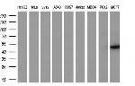 TMOD1 Antibody in Western Blot (WB)