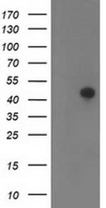 TMOD1 Antibody in Western Blot (WB)