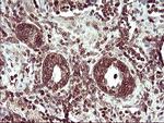 TMX1 Antibody in Immunohistochemistry (Paraffin) (IHC (P))