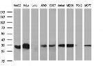 TMX1 Antibody in Western Blot (WB)