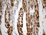 TNFAIP8 Antibody in Immunohistochemistry (Paraffin) (IHC (P))