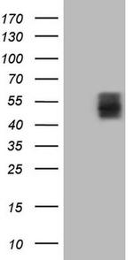 TNFRSF10A Antibody in Western Blot (WB)