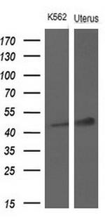 TNFRSF10A Antibody in Western Blot (WB)